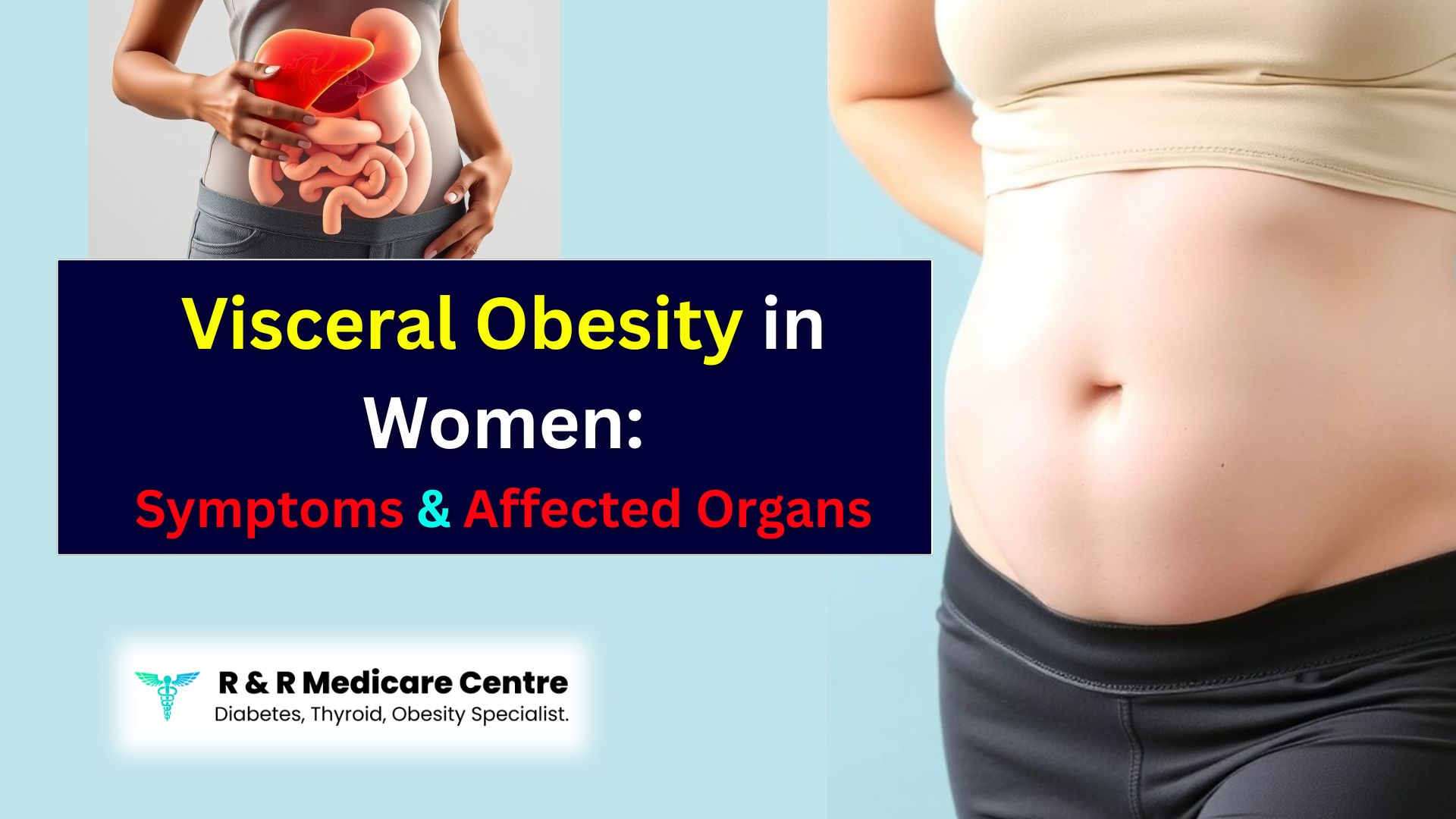 Visceral Obesity in Women Symptoms, Affected Organs, Genetic Factors & Worst Foods